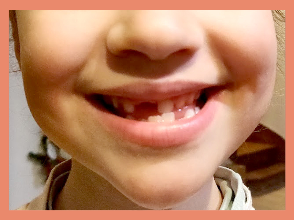 Pourquoi les enfants changent-ils leurs dents de lait ?